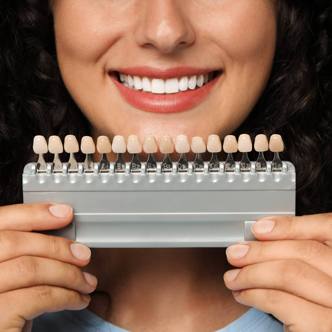 Porcelain Veneers