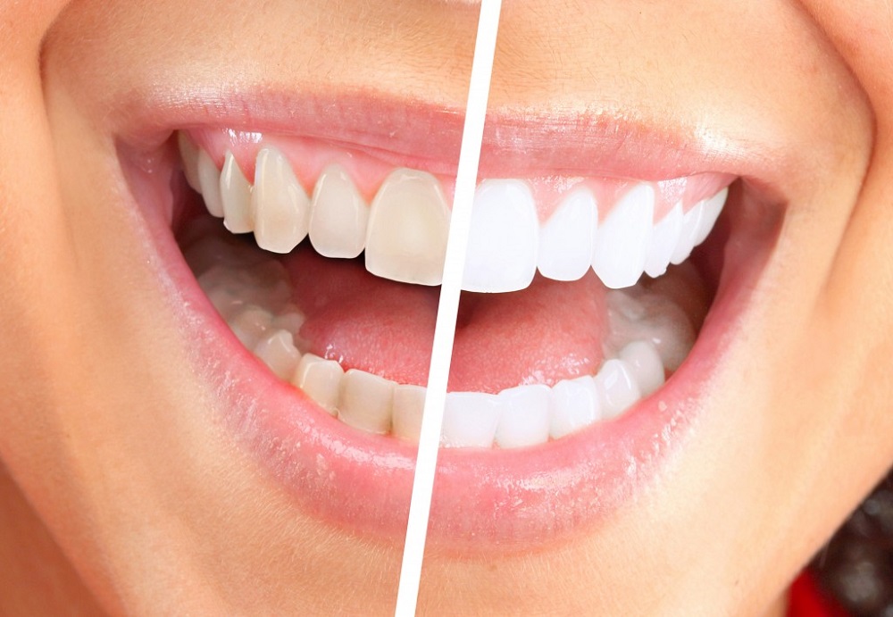 Pediatric Dentistry